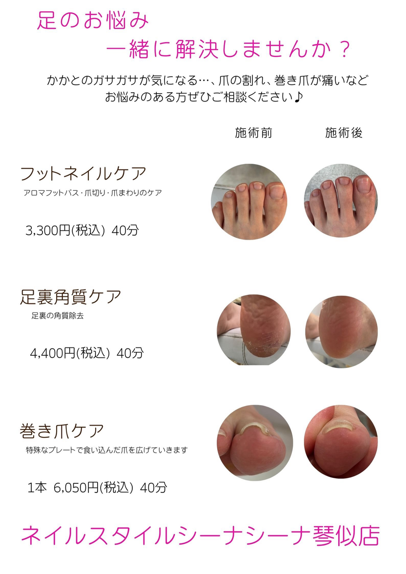夏！いよいよフットの季節　今年は早めの準備始めませんか？